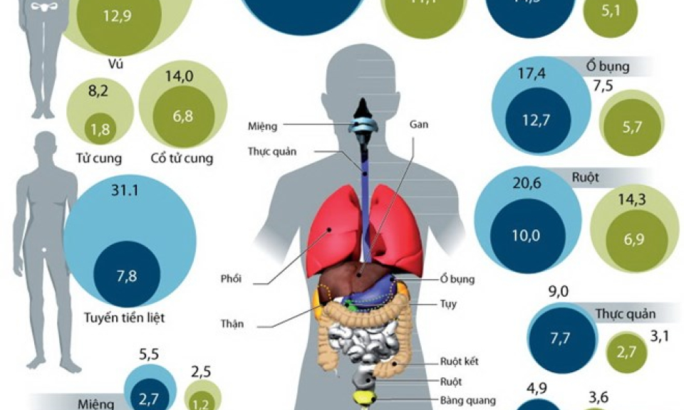 Ung thư - Thách thức lớn về y tế trên toàn thế giới