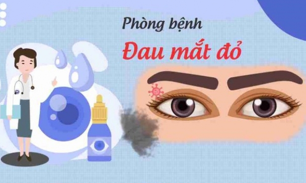 Cách phòng, ngăn ngừa lây lan bệnh đau mắt đỏ