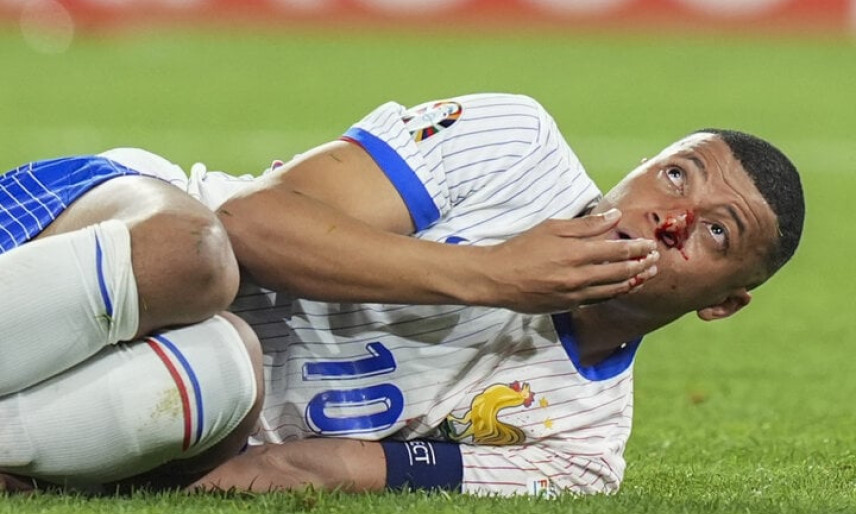 Mbappe vỡ mũi ngay trận ra quân, EURO khắc nghiệt hơn World Cup